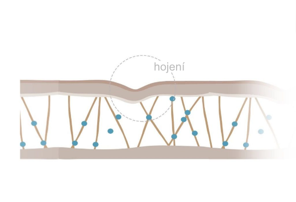 To stimuluje buňky fibroblastů k produkci více kolagenu.