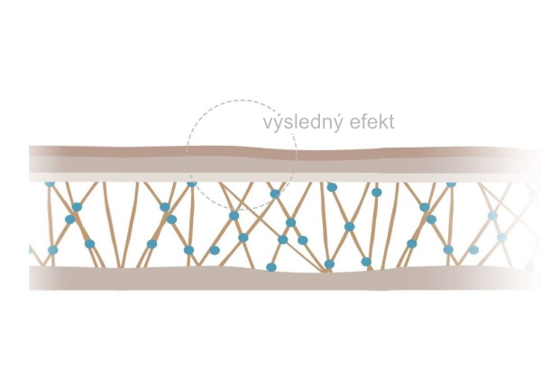 Kolagen se vytváří 4-6 týdnů. Výsledkem je posílená, zářivá a hladší pokožka.